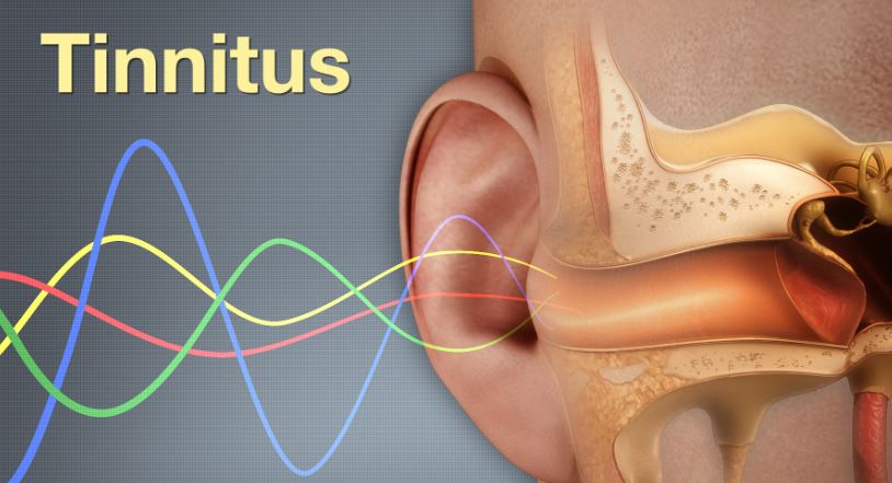 Tinnitus research